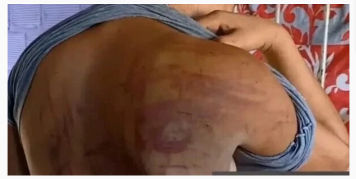 Un hombre drogó, abusó e intentó enterrar viva a su novia en una chacra de Misiones