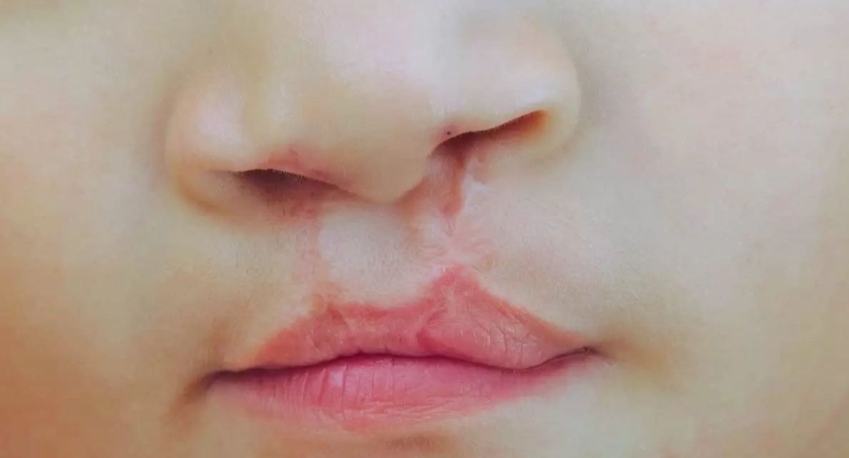 Ley Flap: familias de Santa Cruz piden su reglamentación hace 4 años  