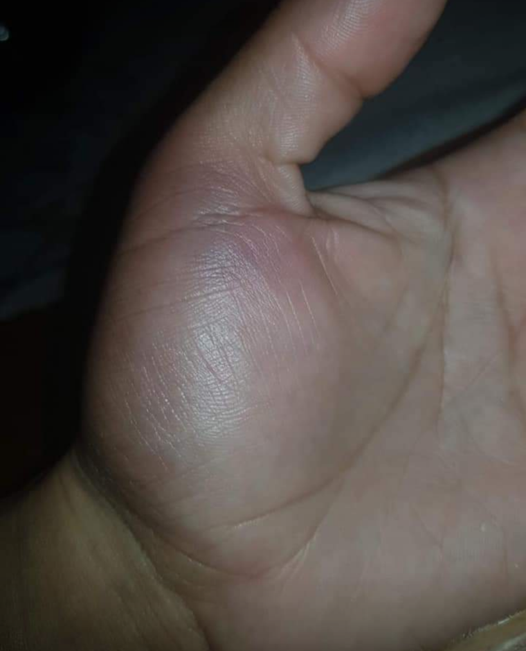 Caso Ada Barroso: la Justicia lo investiga como femicidio y dicta prisión preventiva