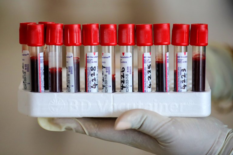 Un nuevo test de sangre permite la detección temprana de 50 tipos de cáncer