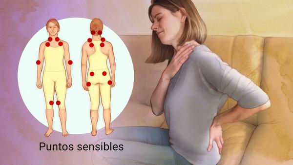 Hay 180 pacientes con fibromialgia: piden que se apruebe una ley que contemple su tratamiento y cobertura al 100 por ciento