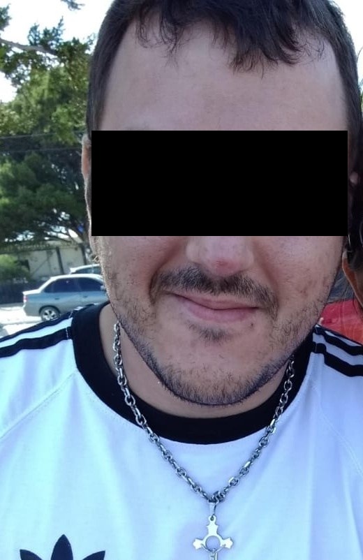 Pico Truncado: acusan a efectivo policial de quebrar el tabique de su pareja a golpes