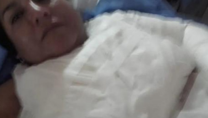 Brutal ataque de una suegra a su nuera: le arrojó una pava de agua hirviendo