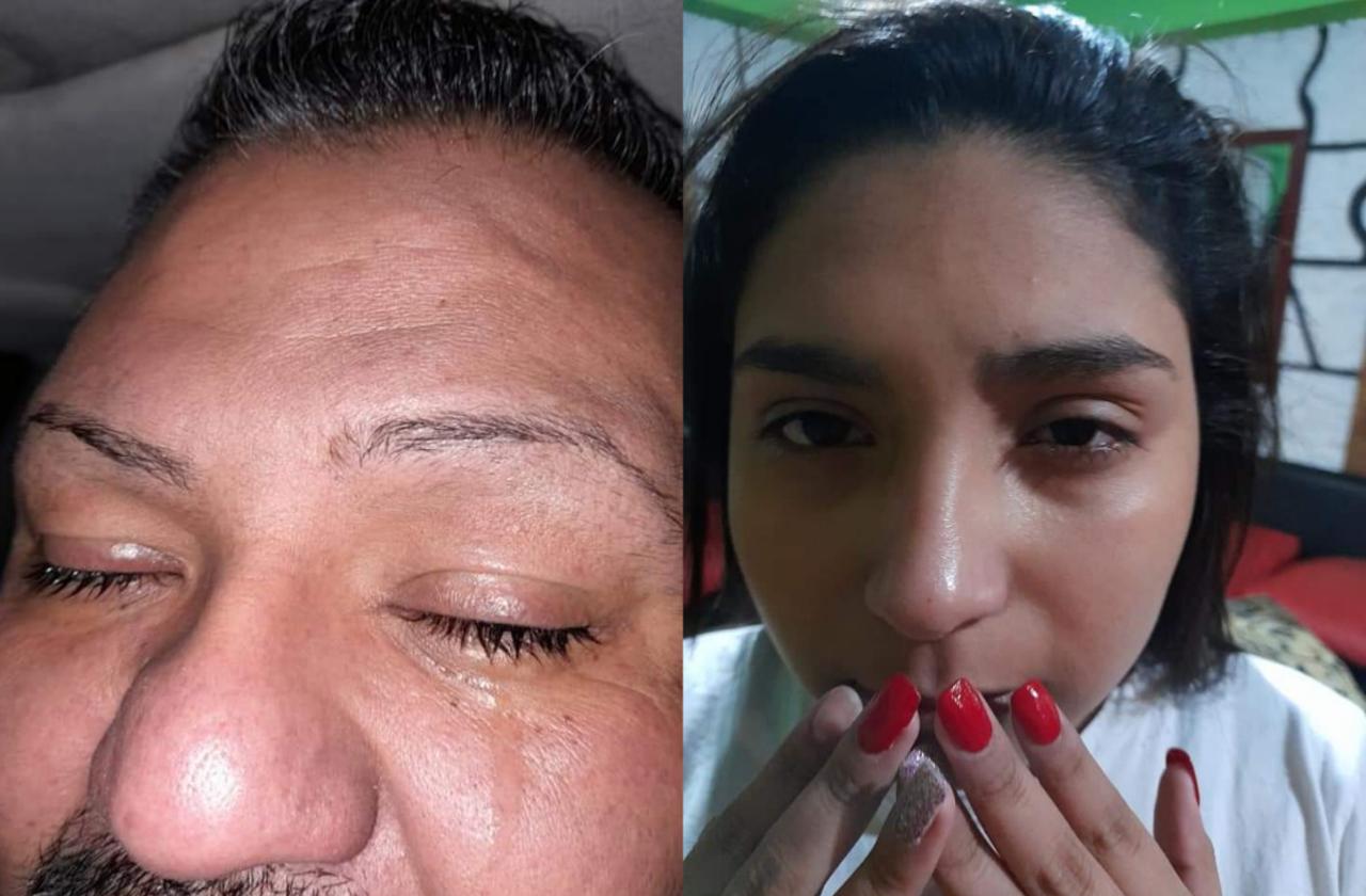 Una familia denunció penalmente a la Sección de Infantería por tirarles gas pimienta en el rostro