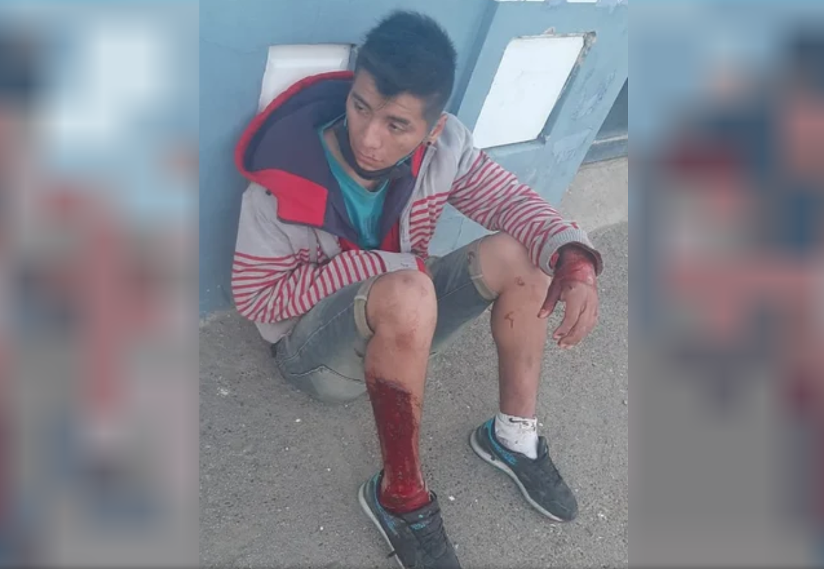 Tomaba alcohol con cinco desconocidos, lo agredieron y le robaron la mochila