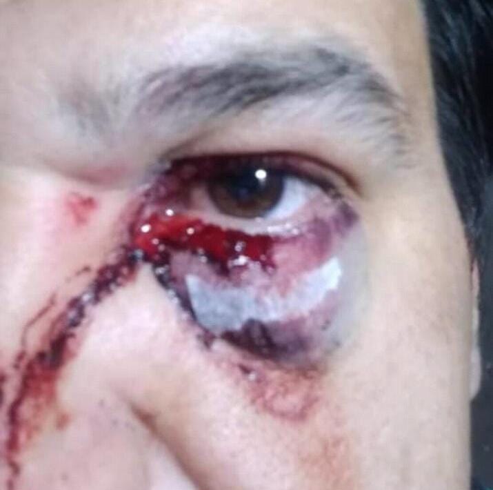 Penoso: un integrante de cuerpo técnico del club Rosales le pego una trompada a un arbitro y se suspende el fútbol oficial