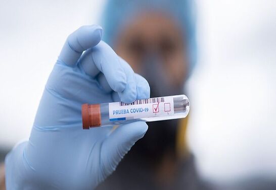 Santa Cruz dio a conocer los datos del informe epidemiológico