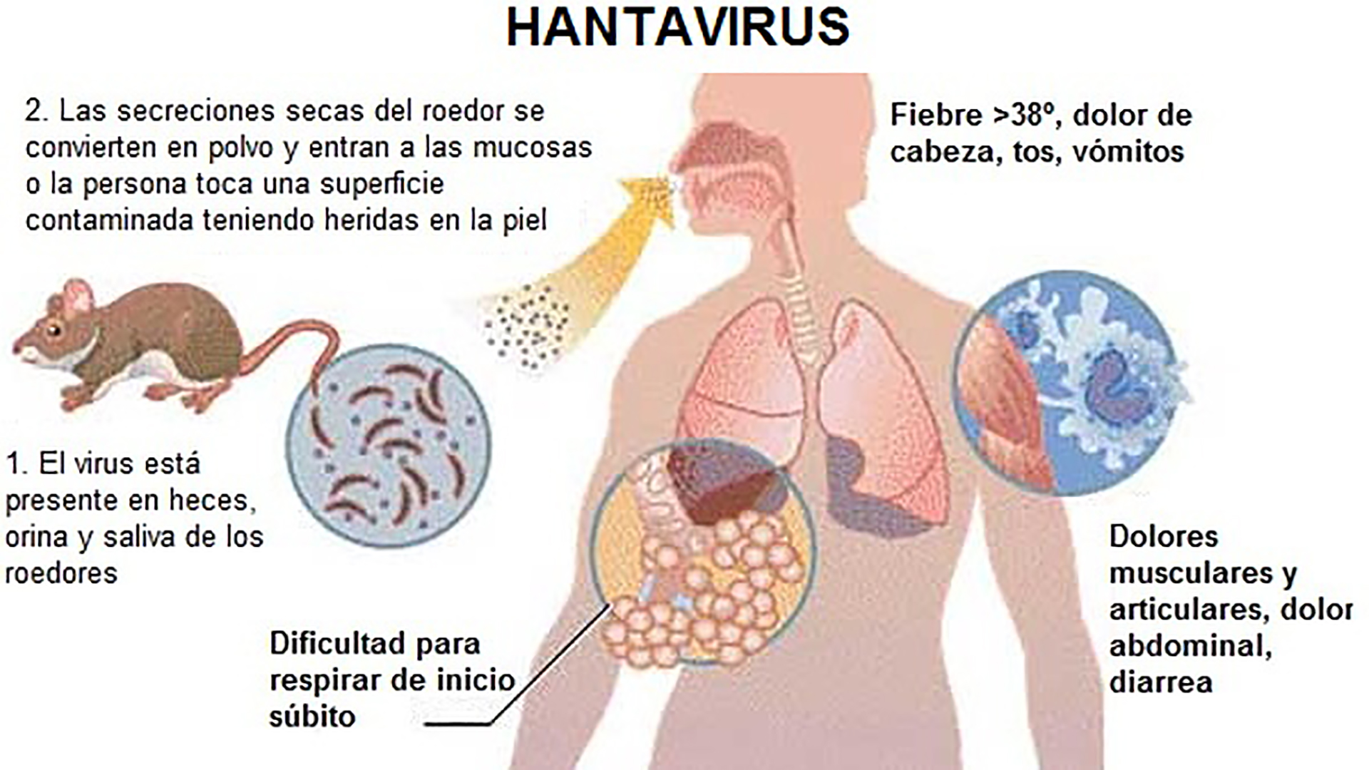 SPSE completó la reparación del acueducto principal de Las Heras