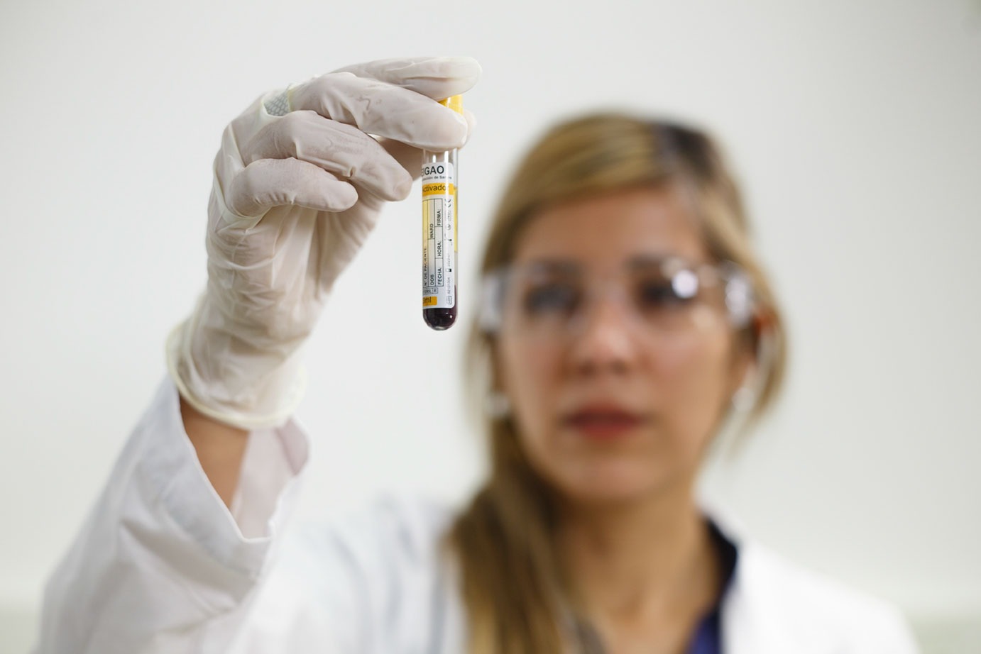 CSS: Búsqueda de profesionales en Oncología, Hematología y Oncohematología 