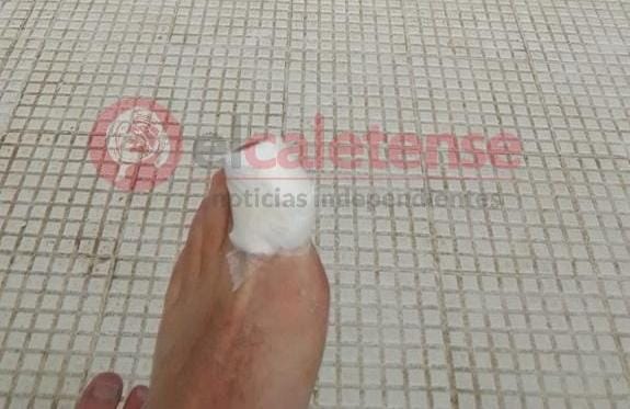 Alumno de natación se corta con venecita desprendida en natatorio municipal