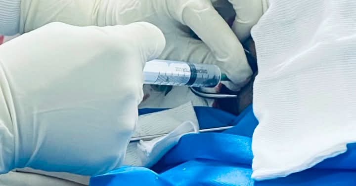 Denuncio amenazas tras un conflicto por una reparación mecánica en Las Heras