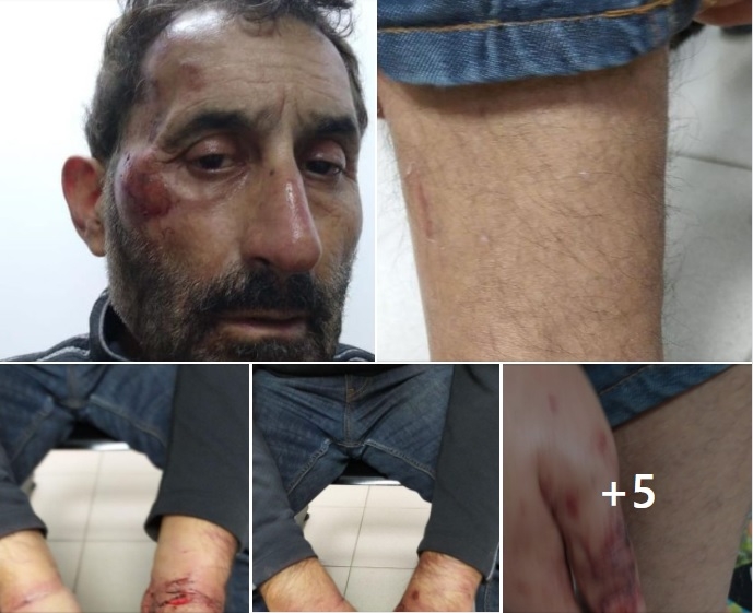 Abuso de autoridad II: denuncian brutal golpiza policial a Anibal Villares, un reconocido comerciante local