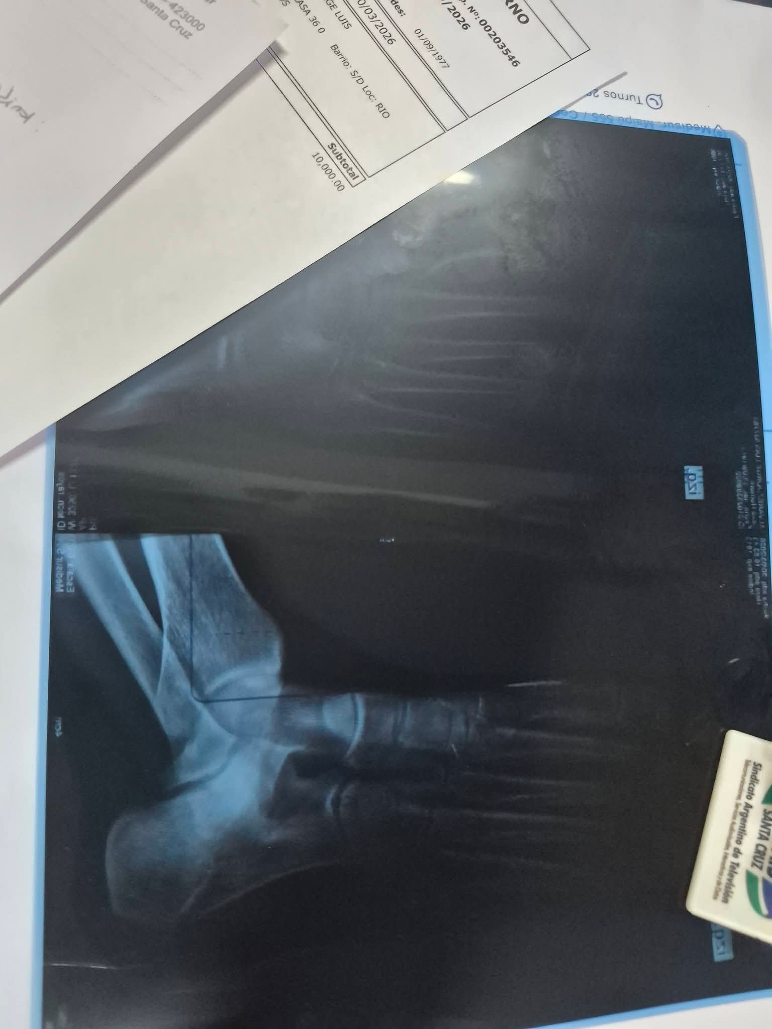 Desmantelan invernadero clandestino de marihuana en barrio Rotary XXIII