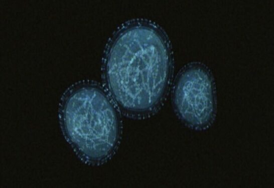 Para un experto de la OMS, 