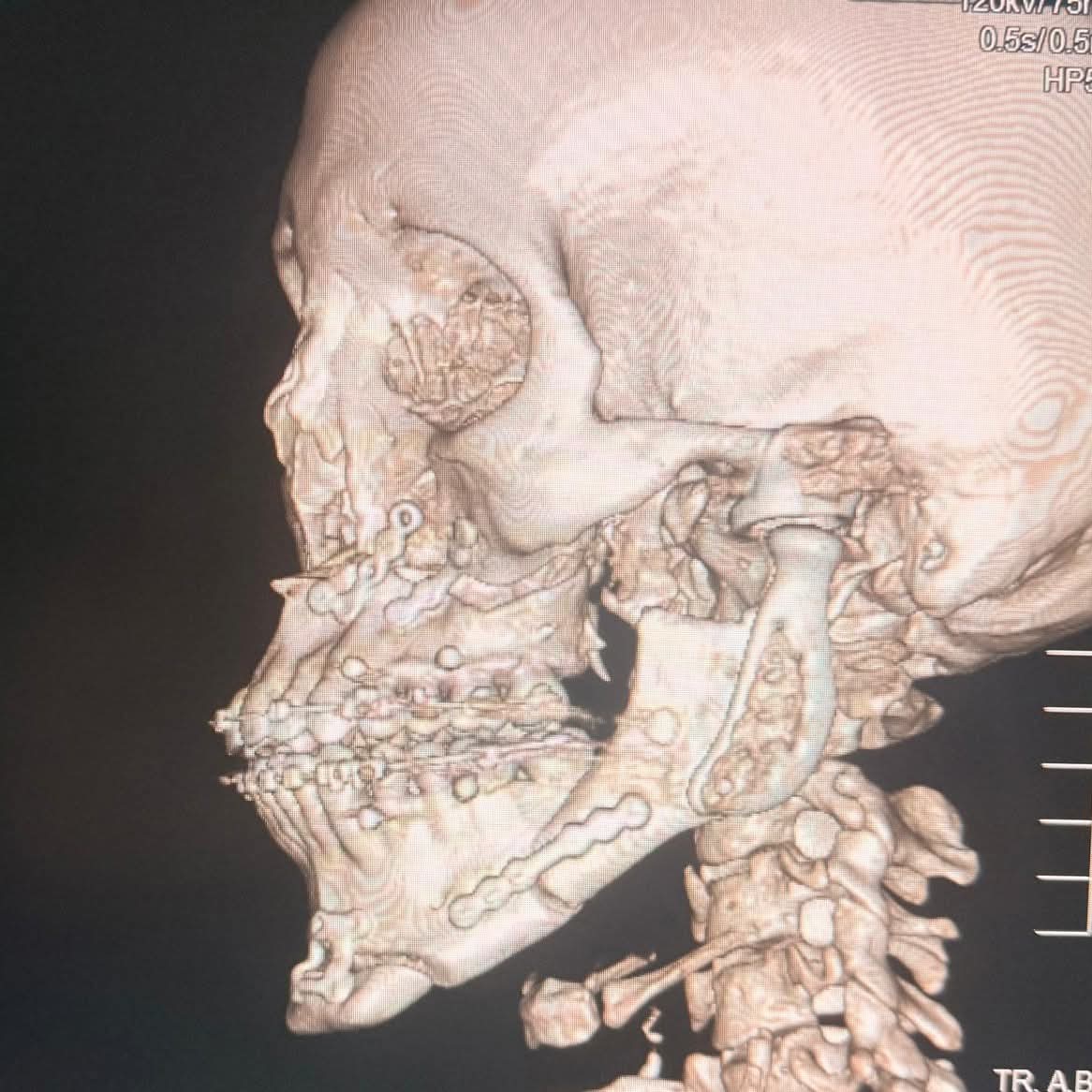 Servicios Públicos trabaja en la iluminación de la calle 22 de Río Gallegos