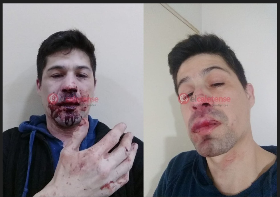 Caleta Olivia: cuatro hombres golpearon a un referente político dentro y fuera de un pub