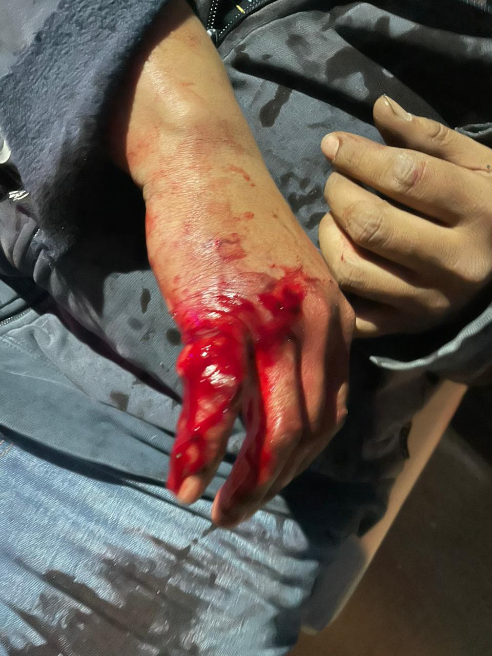 La gestión de Claudio Vidal invierte 190 millones de pesos para llevar agua al barrio 22 de Septiembre