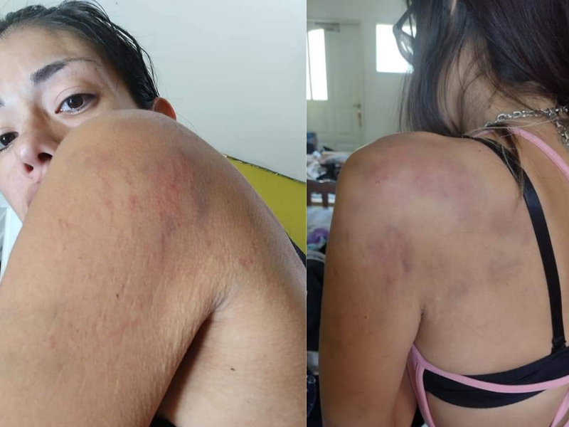 Denunció publica y judicialmente al papá de su bebé luego de la brutal golpiza que le propinó