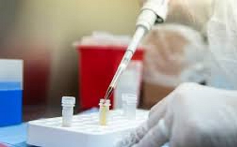 Quedan 9 casos sospechosos en Santa Cruz y en Caleta Olivia dio negativo la que venia de Alemania y apareció otro caso sin nexo epidemiologico