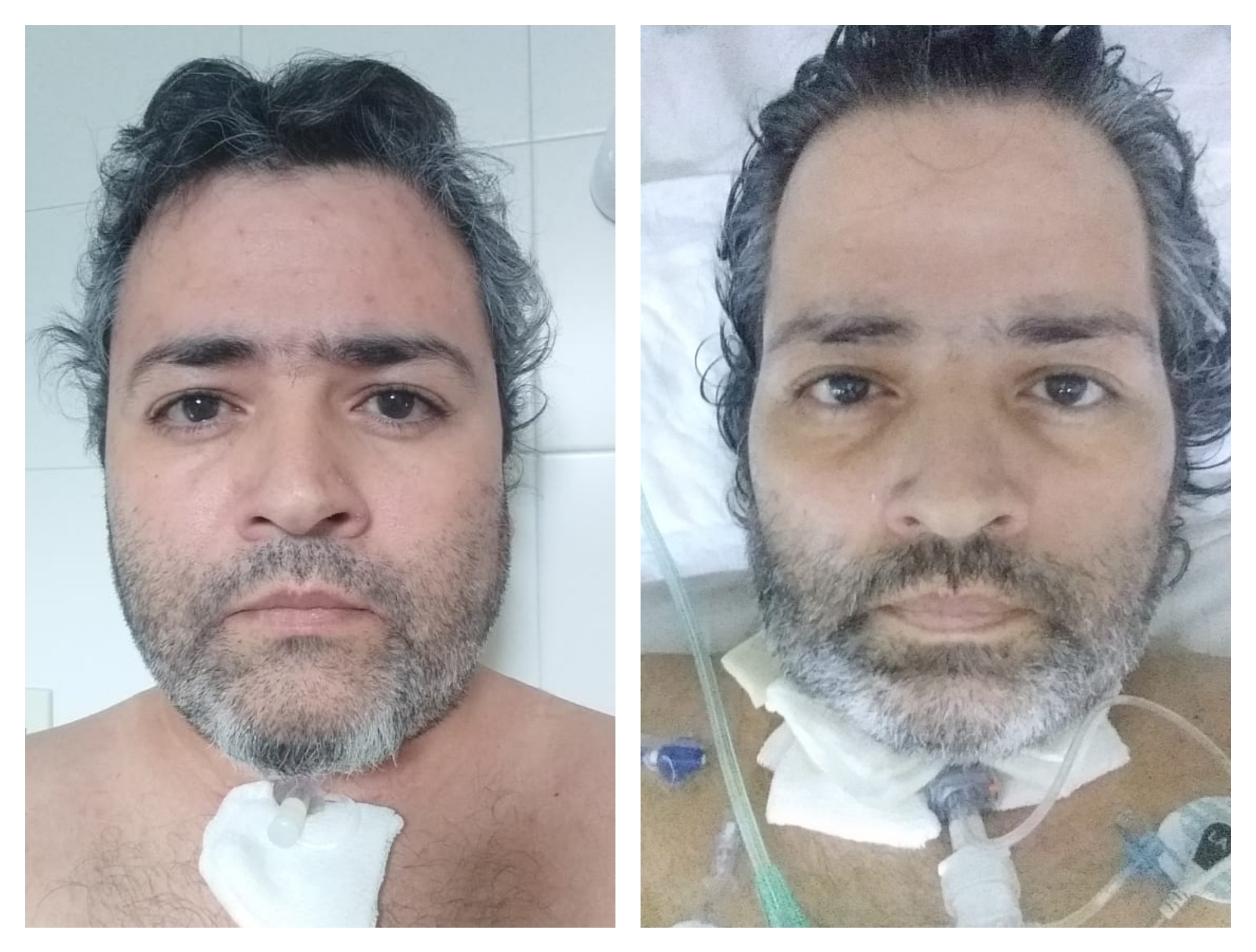 Tuvo COVID, le hicieron una mala práctica médica y le pide a la CSS que se haga cargo del avión sanitario para volver de Bs.As a Caleta 