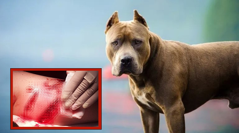 El perro había producido heridas que requirieron 72 puntos: Por decisión de los dueños ayer mataron al pitbull que mordió a la joven Perla Leal
