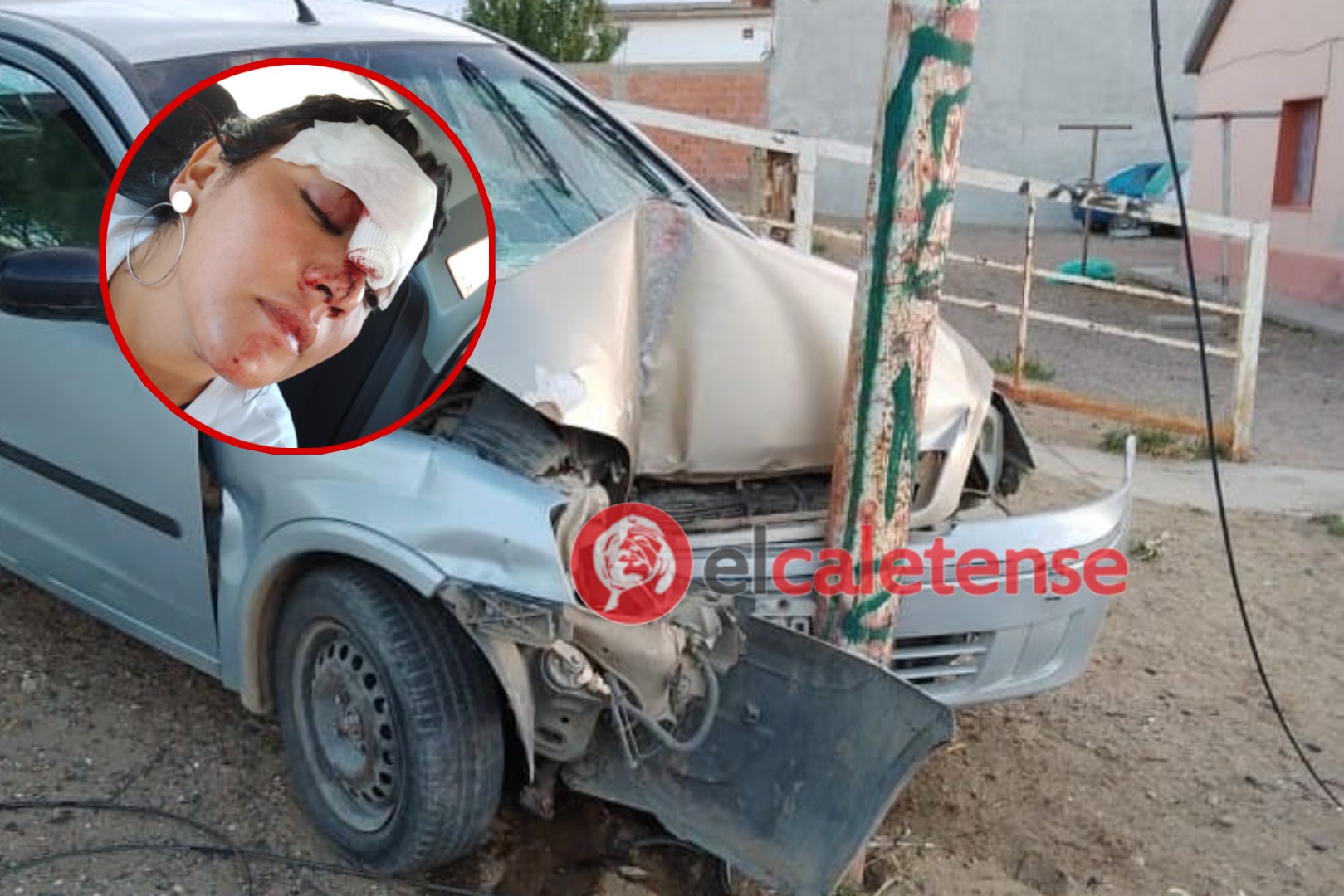 Intento de femicidio: persiguió a la ex novia después del boliche y la atropelló contra una palma de luz 