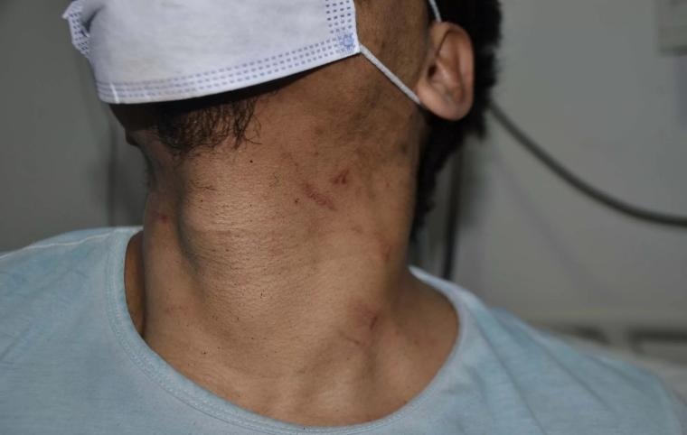 Habrá una movilizacion en Rio Gallegos por el enfermero golpeado