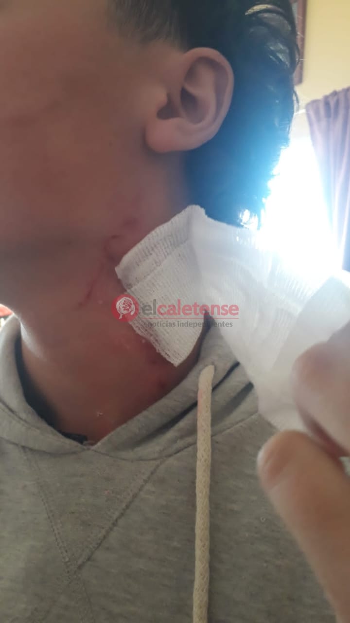 La gestión de Claudio Vidal invierte 190 millones de pesos para llevar agua al barrio 22 de Septiembre