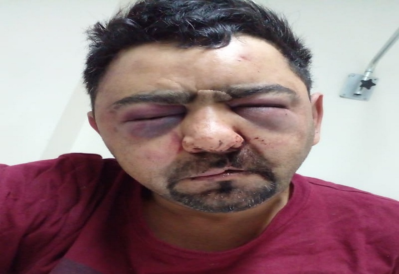Un hombre denuncia que fue brutalmente golpeado por policías en la comisaria de Puerto Deseado