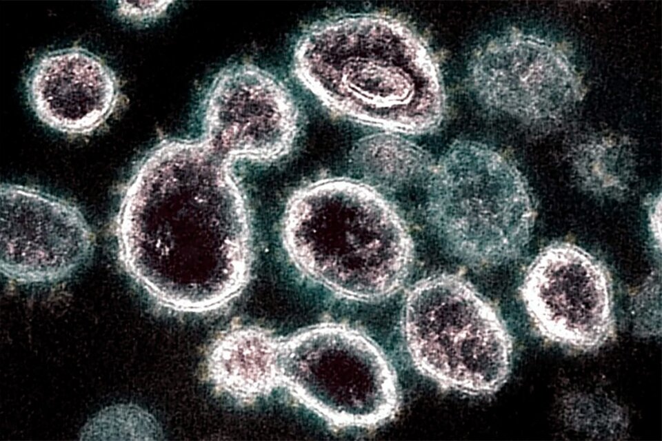 El masitinib podría ser la droga más eficaz contra el coronavirus
