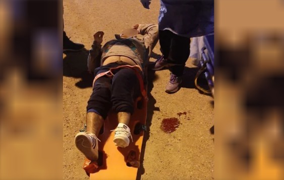 Comodoro Rivadavia: un amigo de su expareja le disparó en la calle y está internado