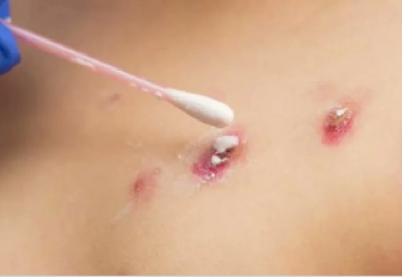 Desmantelan invernadero clandestino de marihuana en barrio Rotary XXIII